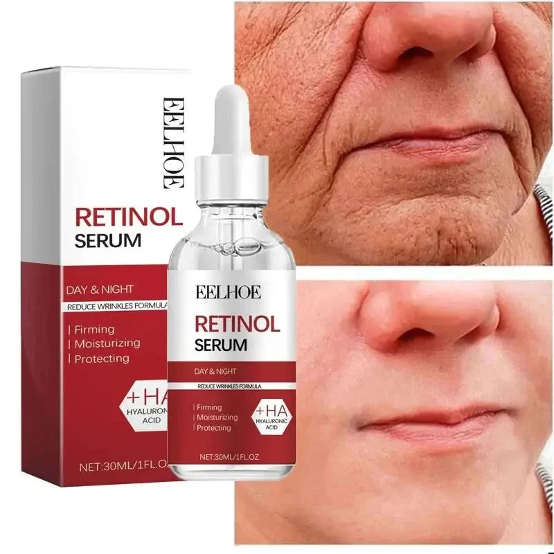 Retinol Anti-Aging Face Serum Set — Firms, Lifts & Fades Fine Lines