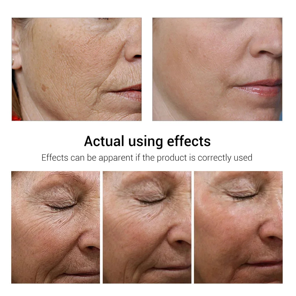 Retinol Anti-Aging Face Serum Set — Firms, Lifts & Fades Fine Lines
