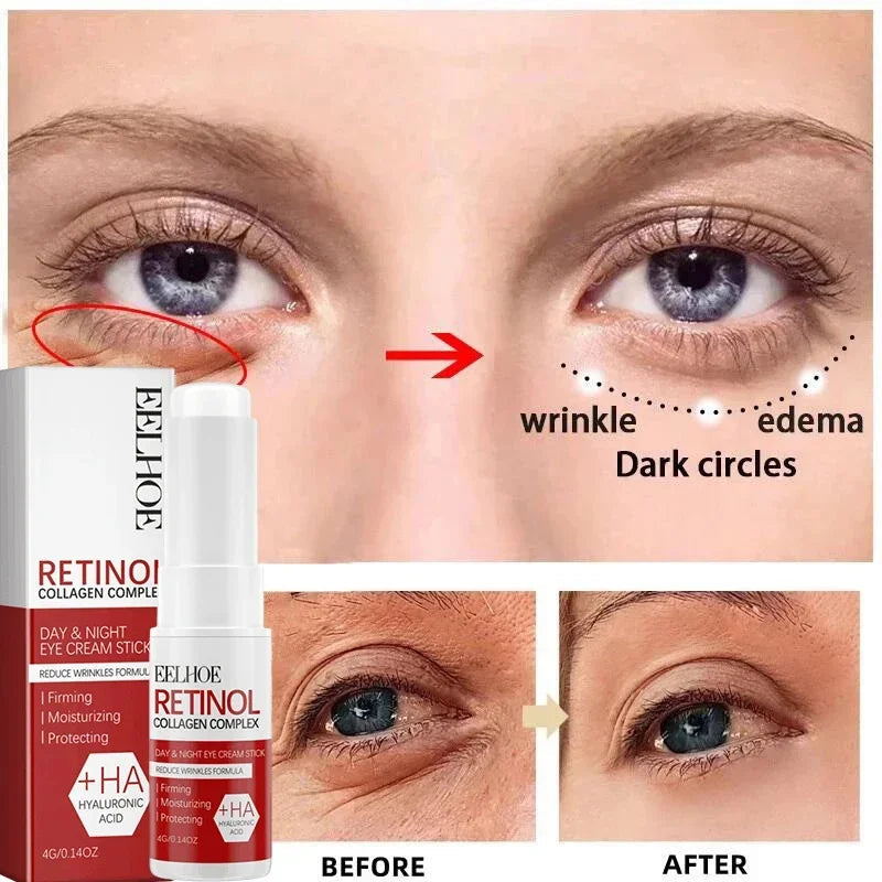 Retinol Anti-Aging Face Serum Set — Firms, Lifts & Fades Fine Lines