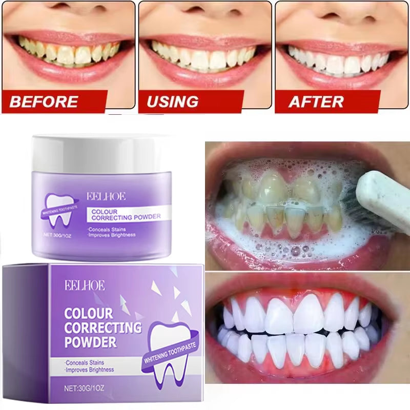 5-Day Teeth Whitening Powder — Remove Plaque, Stains & Bad Breath