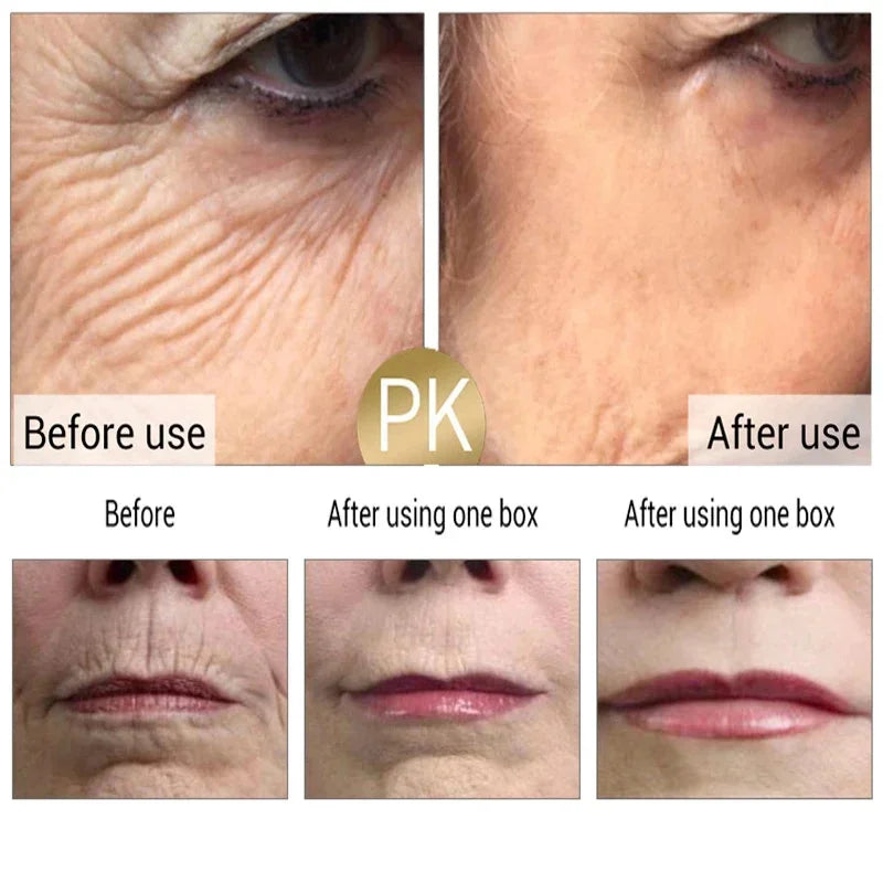 Retinol Anti-Aging Face Serum Set — Firms, Lifts & Fades Fine Lines